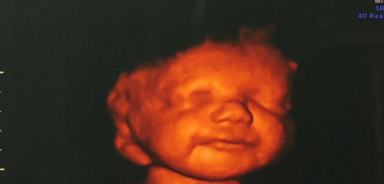 Uśmiech uratował życie niepełnosprawnemu dziecku