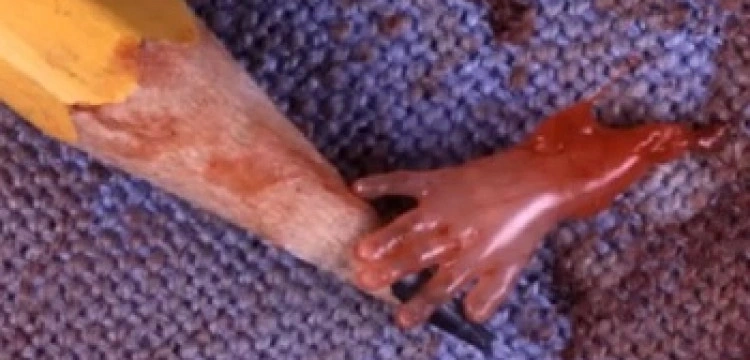 Spada liczba aborcji w Hiszpanii