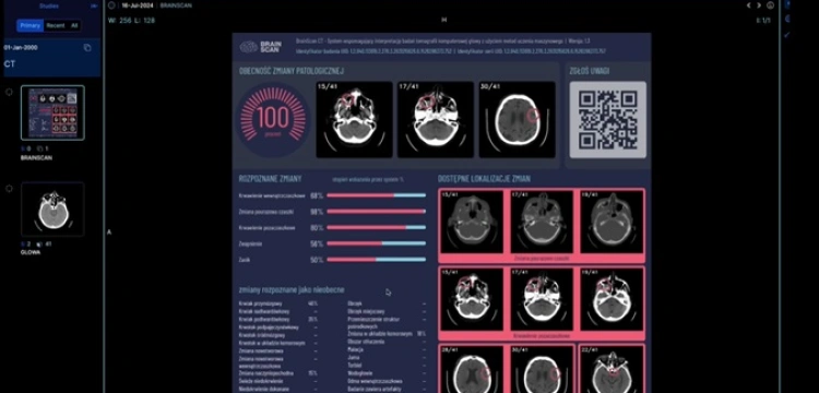 Polska AI pokonała 1300 konkurentów wygrywając największy konkurs medyczny świata [Wideo]