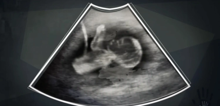 Świadectwo byłej aborcjonistki Diny Madsen: Bóg uświadomił mi brzydotę aborcji