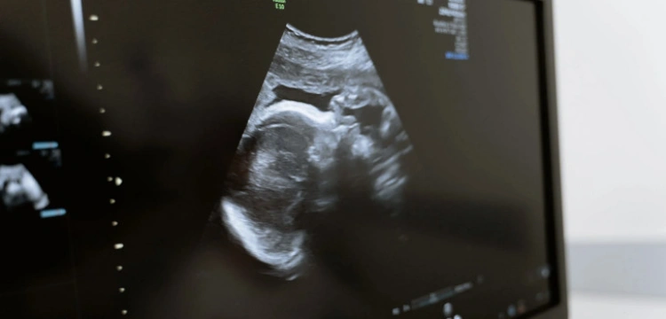 Tragedia pani Doroty i kolejny atak lobby aborcyjnego