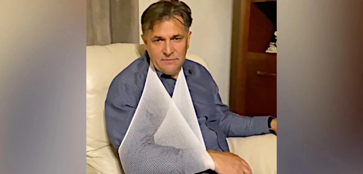 Napaść na posła PiS. Prokurator przekazał nowe informacje o sprawie