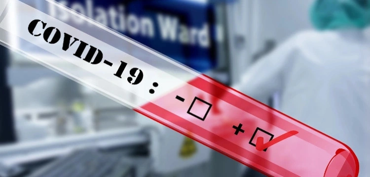 Koronawirus znika, wraca grypa. Gdyby nie testy, pandemii by nie było?