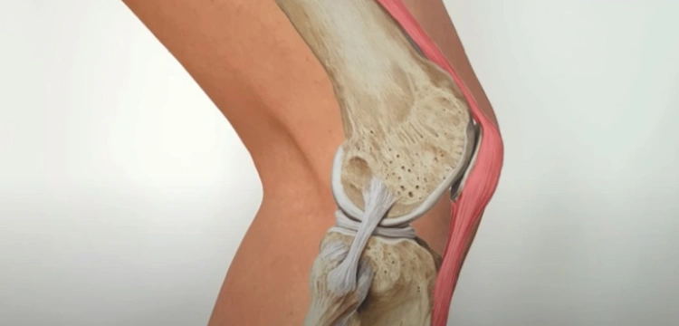 Uwaga: Twoje stawy gniją od kwasu moczowego? Tak je oczyścisz