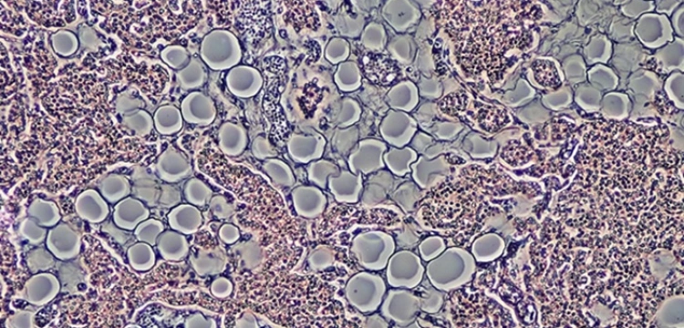 Jak terapia komórkami macierzystymi rewolucjonizuje medycynę [Materiał promocyjny]