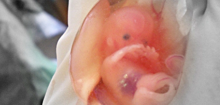 Świadectwo: Bóg pokazał nam jakie są skutki grzechu aborcji
