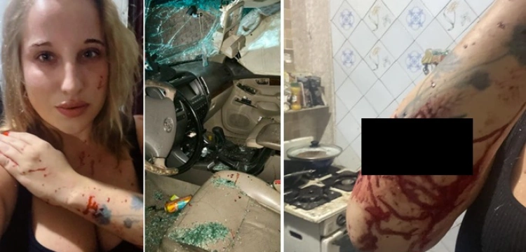 Polska dziennikarka ranna w bandyckim ataku Rosji na hotel w Kramatorsku