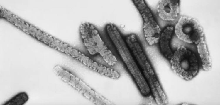 Śmiercionośny wirus zbiera pierwsze żniwa. Umiera na niego nawet 88 proc. zakażonych