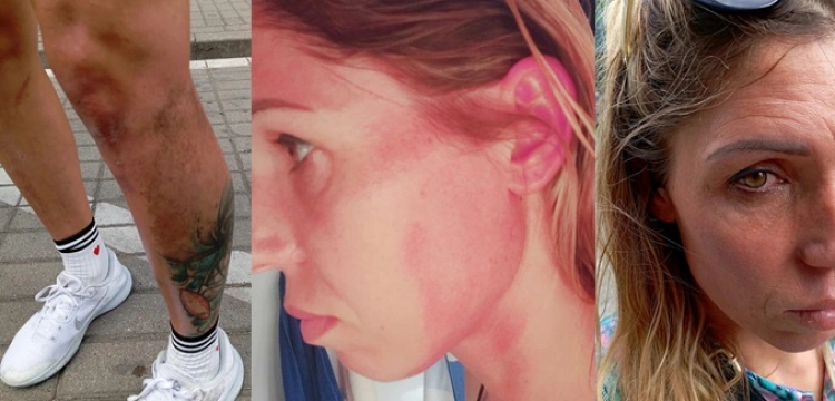 Policja i Muzeum Powstania Warszawskiego zabrały głos ws. pobicia Zofii Klepackiej