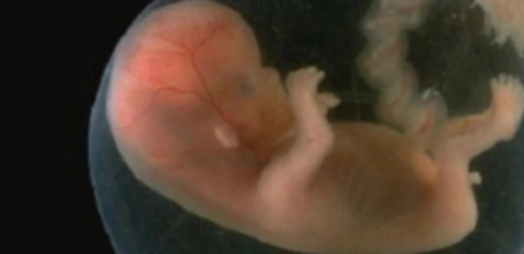 Szpital w Gdańsku zabija dzieci z „przesłanki psychicznej” nawet w 7. miesiącu życia!